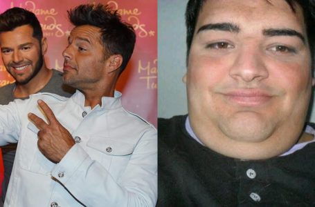 Este argentino pasó por 30 cirugías para verse como Ricky Martin